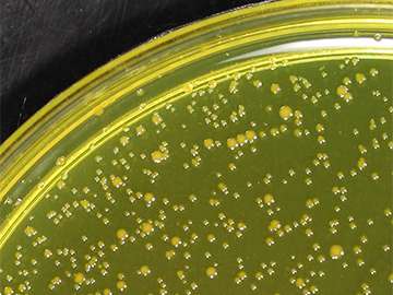 Bacteria show surprising number of genetic paths to survival