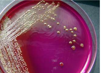 Bacteria to spot pollution