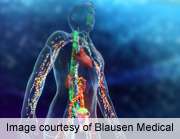 Biomarker identified in systemic sclerosis predicts progression