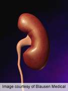 Biopsy-based algorithm found accurate for small renal masses