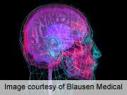 Bipolar disorder drugs may 'Tweak' genes affecting brain