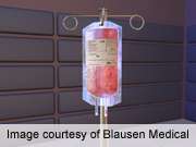 Blood transfusions in cardiac surgery may up infections