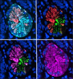 Brain-building gene plays key role in gut repair