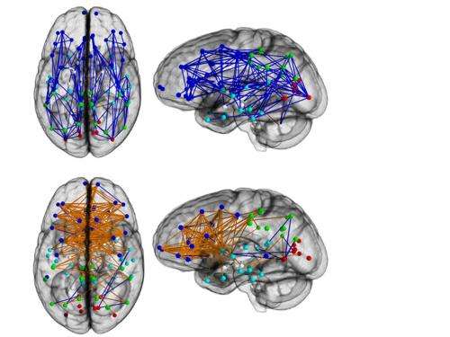 Brain connectivity study reveals striking differences between men and women