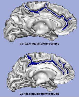 Brain shape affects children's learning capacities