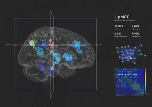 Brain visualization prototype holds promise for precision medicine