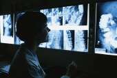 Breast CA diagnostic errors major cause of malpractice suits