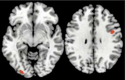 Carnegie Mellon brain imaging research shows how unconscious processing improves decision-making