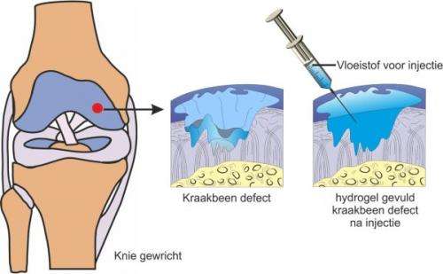 Cartilage restored using imitation human tissue: End of expensive knee implants in sight