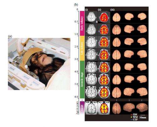 Cerebral development in chimpanzees: Human intelligence secrets revealed by chimp brain