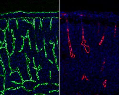 Chance finding reveals new control on blood vessels in developing brain
