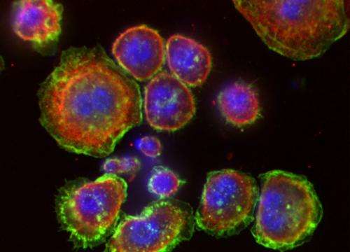 Changes in cell shape may lead to metastasis, not the other way around