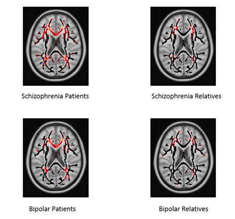 Common biology shared in schizophrenia and bipolar disorder