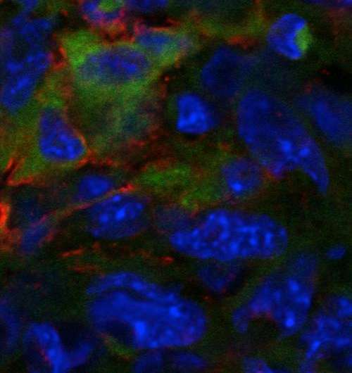 Depletion of 'traitor' immune cells slows cancer growth in mice