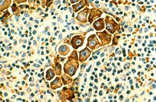 发育蛋白在癌症传播中起着作用