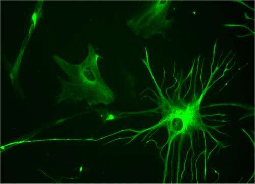 Discovery that some seizures arise in glial cells could offer new targets for epilepsy treatment