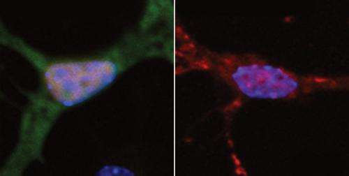 DNA damage may cause ALS