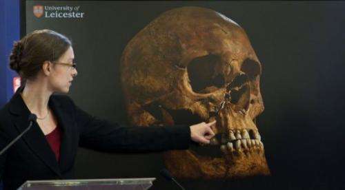 Dr Jo Appleby of Leicester University points to an image of king Richard III's skull on February 4, 2013