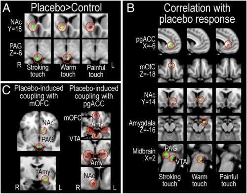 Mind over gray matter: Placebo improves both pleasure and pain