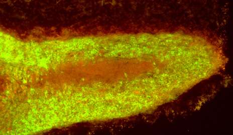 Fast-acting virus targets melanoma in mice