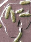 Fecal 'Transplant' to cure gut infection?