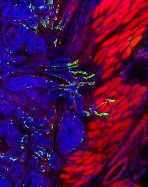First step of metastasis halted in mice with breast cancer
