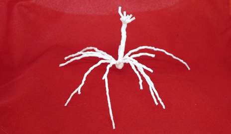 From knee to neuron, offspring of Yale’s 3D printers multiply