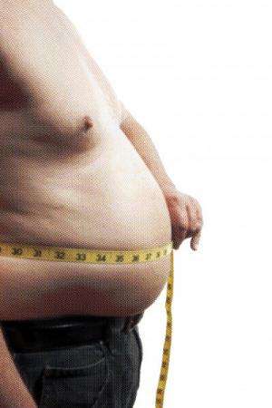 Gastric banding an effective long-term solution to obesity