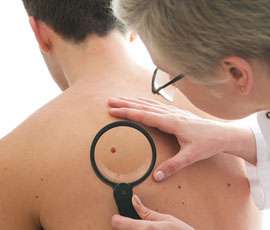 Gene identified in some melanoma linked to increased resistance to treatment