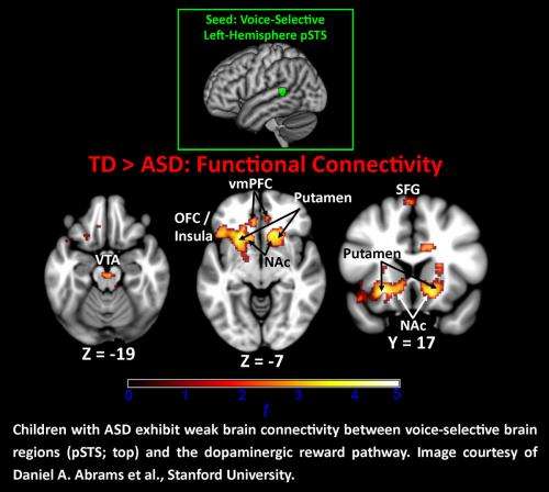 Voices may not trigger brain's reward centers in children with autism, research shows