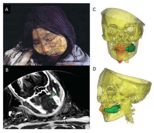 New study shows frozen mummy Inca children given coca and alcohol before sacrifice