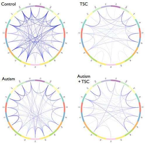 'Network' analysis of the brain may explain features of autism