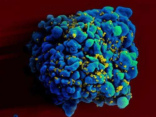 HIV-like virus suppressed in monkey experiment