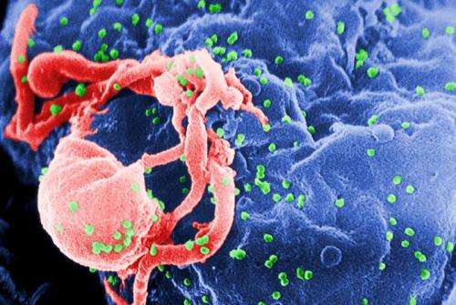 HIV virus spread and evolution studied through computer modeling