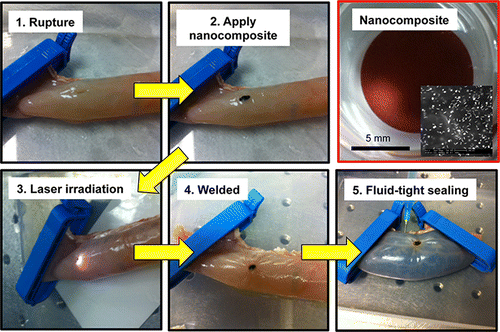 Improved material for 'laser welding' of tissue in intestinal surgery