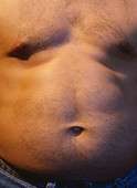 In CAD, highest mortality risk for central obesity, normal BMI