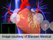 Inclusion of ABI may better identify vascular disease