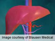 Increase in proportion of livers not used for transplantation