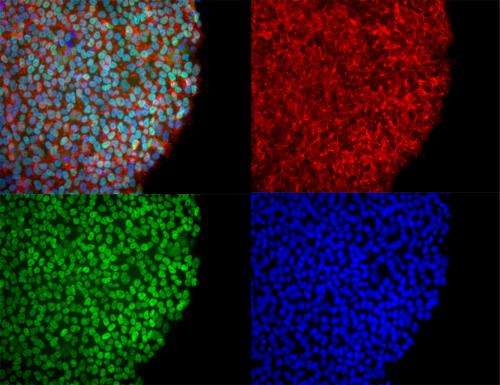 Induced pluripotent stem cells reveal differences between humans and great apes