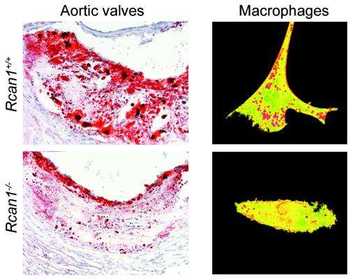 Inhibiting a single protein could improve the treatment of atherosclerosis