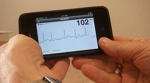 iPhone device detects heart rhythm problem that can cause stroke