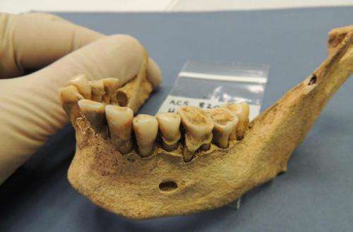 Ancient teeth bacteria record disease evolution
