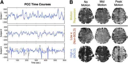 Improving our image: Motion-tolerant BOLD fMRI improves signal-to-noise, functional connectivity analysis and statistica