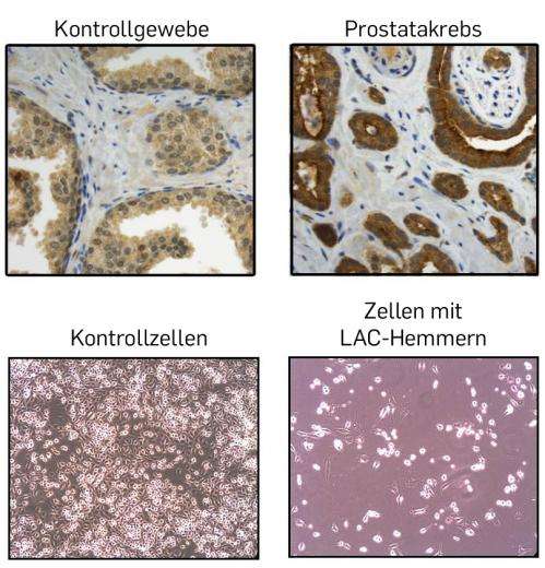 Researchers suppress cell division in prostate tumour tissue through enzyme inhibition