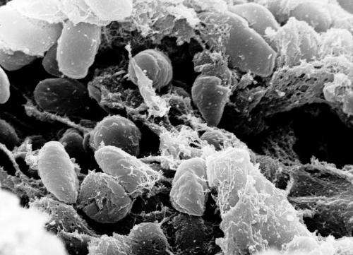 Modern lab reaches across the ages to resolve plague DNA debate