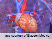 Most cardiac patients report using alternative treatments