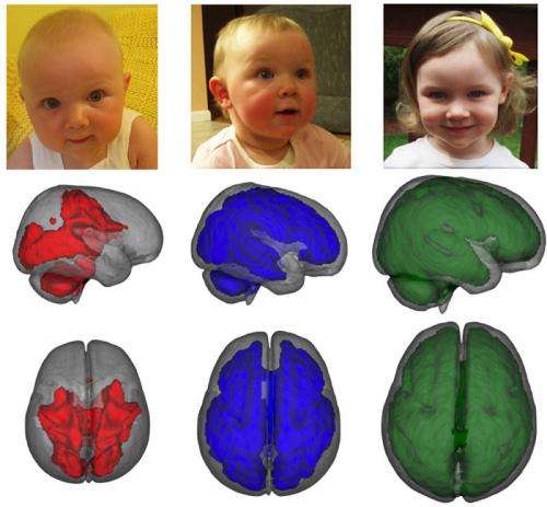 MRI study: Breastfeeding boosts babies' brain growth