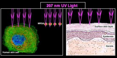 Narrow-spectrum UV light may reduce surgical infections