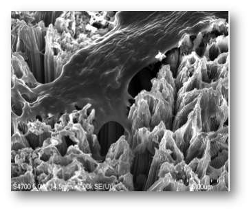 New nanotube surface promises dental implants that heal faster and fight infection