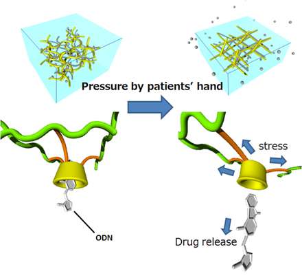 Novel drug delivery system releases drugs in response to compression by the patient’s hand
